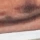 Nmiiiii